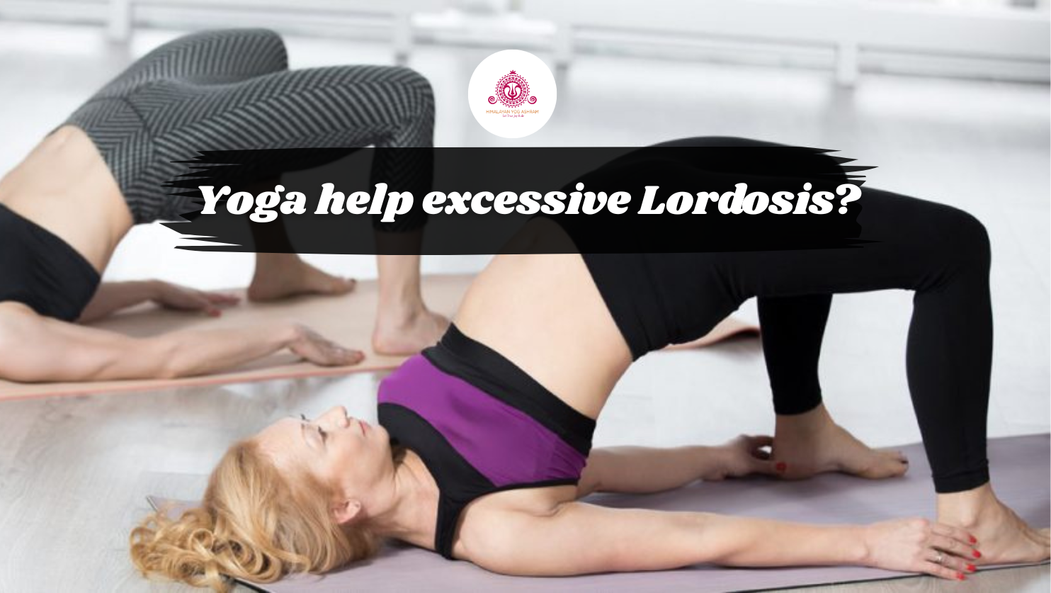 Can Yoga help with excessive Lordosis?